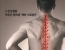 [헬스엔 라이프 칼럼] 건강한 척추관절 지키기_노인성질환 ‘척추관 협착증’ 예방·치료법은?